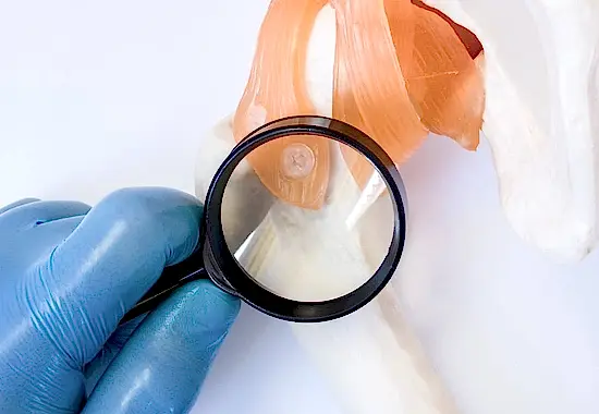 Kronik Kas-İskelet Sistemi Rahatsızlığı